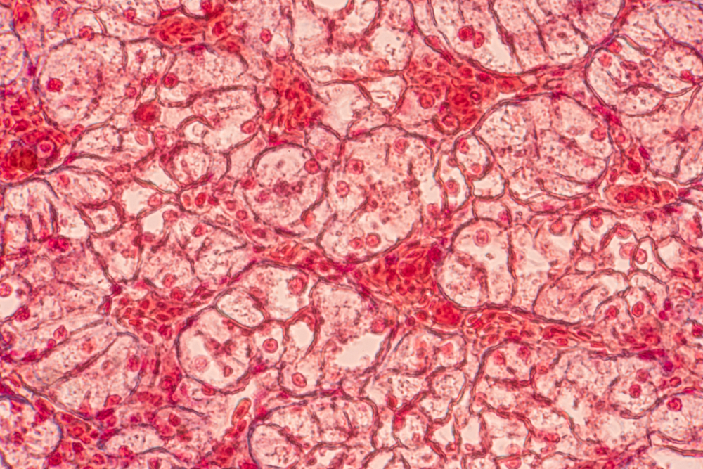 What is Altered intercellular communication and how to counter it! 1 shutterstock 1071089975